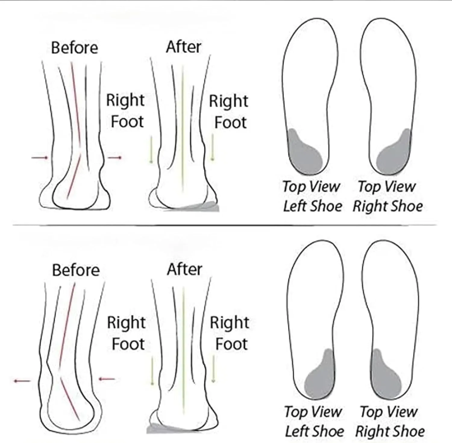 Women's Soft Sole Mesh Comfort Orthopedic Shoes, Women's Lightweight Soft Sole Mesh Comfort Orthopedic Shoes